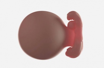 5. Schwangerschaftswoche